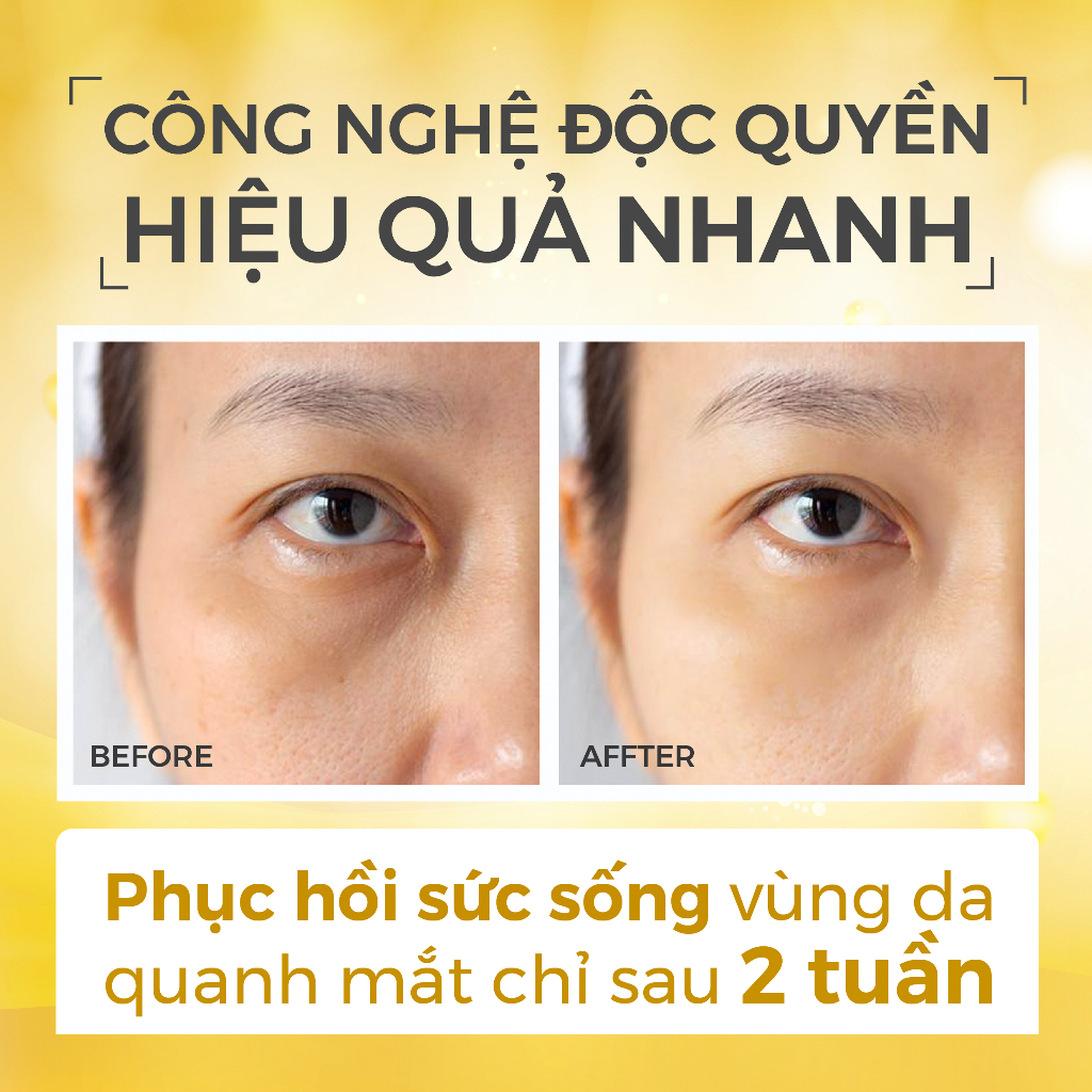 Kem mắt chống lão hóa giảm quầng thâm bọng mắt Recipe Lifting Recipe Dark Cover Eye Cream 30ml