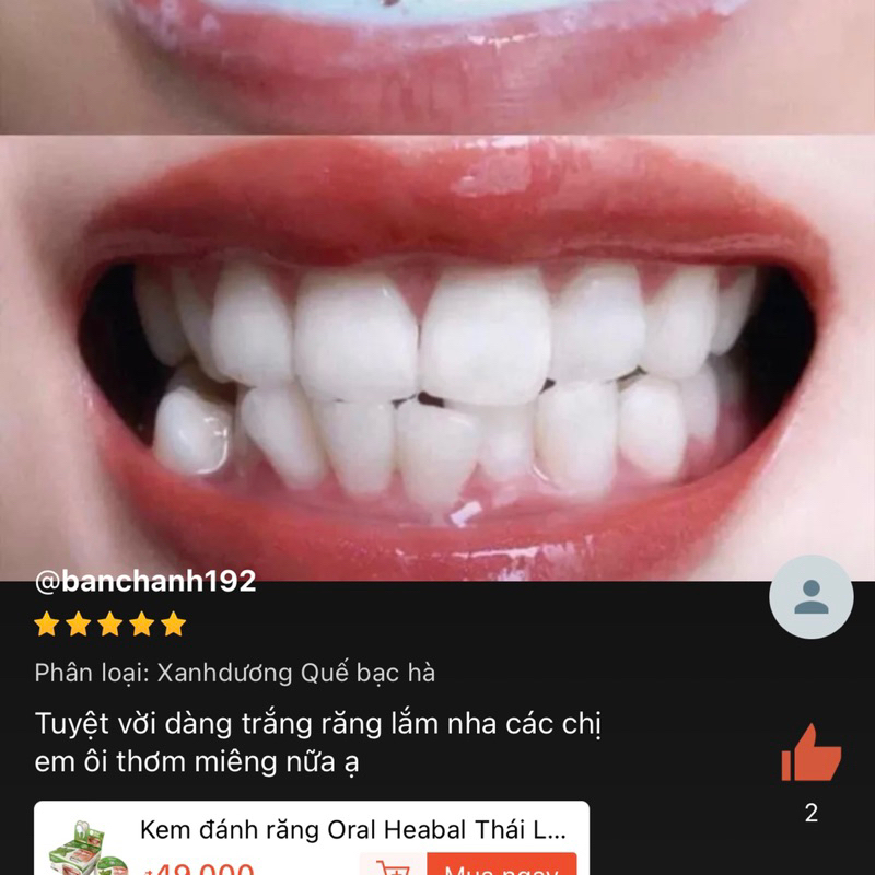 Kem đánh răng Oral Heabal Thái Lan, dùng cho người niềng răng, trắng răng thơm miệng, thảo dược