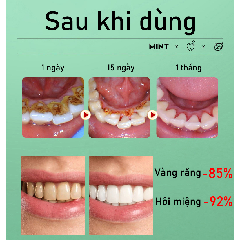 Kem Đánh Răng Làm Trắng Răng loại bỏ cao răng hôi miệng tẩy ố vàng 100g Không Chứa Florua Kem đánh răng bạc hà