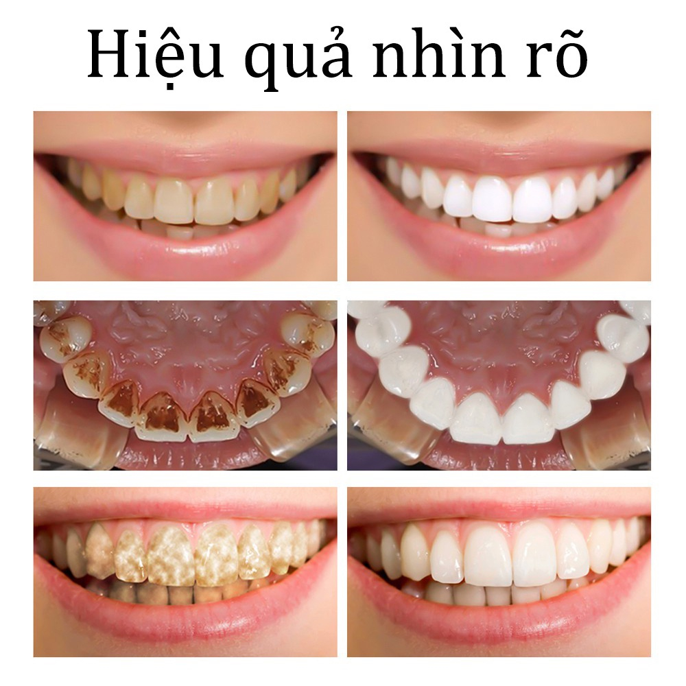 Kem Đánh Răng Làm Trắng Răng loại bỏ cao răng hôi miệng tẩy ố vàng 100g Không Chứa Florua Kem đánh răng bạc hà