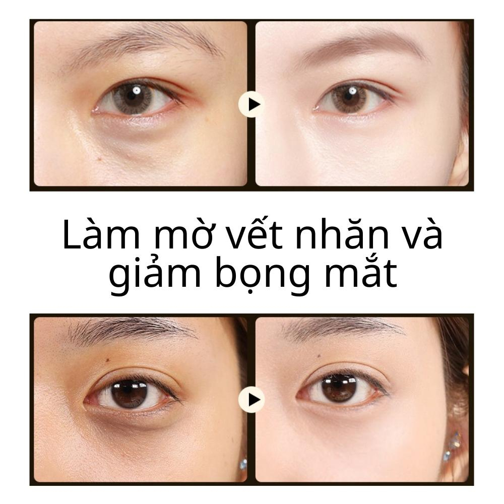 Mặt nạ mắt dưỡng ẩm làm mờ quầng thâm mắt và nếp nhăn, mặt nạ chăm sóc mắt với tinh chất collagen (hộp 60 miếng)