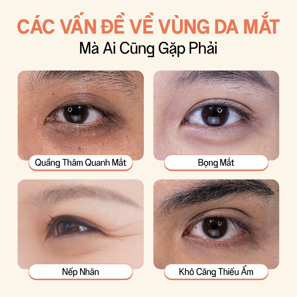 Kem Mắt Retinol Nhân Sâm Thuần Chay Mờ Thâm Giảm Nhăn Vegick Youth Eye Cream 15ml