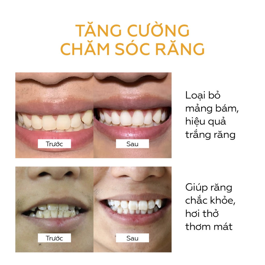 Bột trắng răng than Ngọc Trai UMIHA (30g) – Trắng răng với bột trắng răng thành phần Than hoạt tính, Canxi, Bột than tre