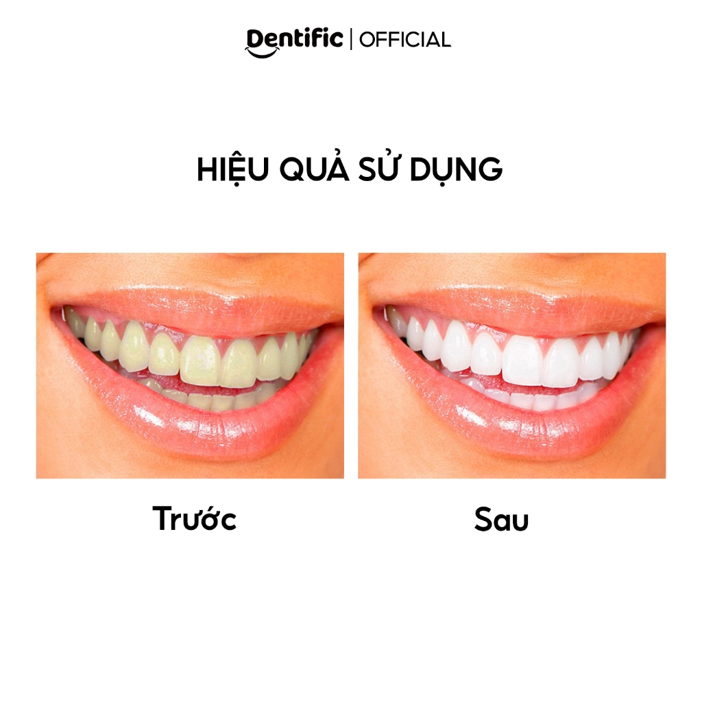 Kem đánh răng làm trắng và sạch răng Bright Me Smile Charcoal toothpaste Dentific 100g