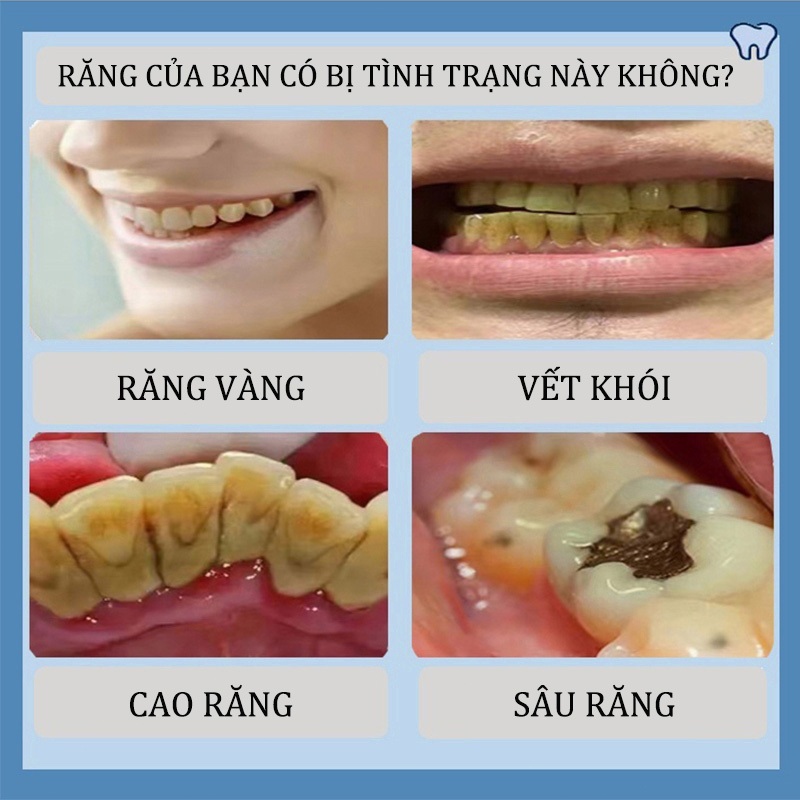 Bột Trắng Răng Kem đánh răng trắng 50g Làm trắng răng nhanh chóng hết ố vàng khử mùi hôi miệng giảm viêm loét miệng