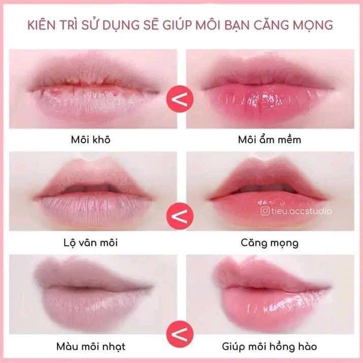 [TẶNG CỌ TÁN] Son dưỡng môi Vaseline Hộp thiếc 20g Vaseline Lip Therapy Bill Anh