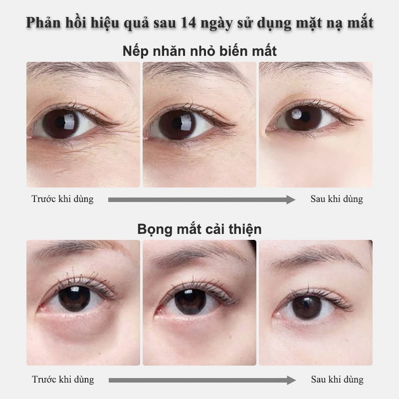 Mặt Nạ Mắt Chống Nếp Nhăn chống thâm mắt Loại bỏ bọng mắt 80 miếng Giữ Ẩm Làm Mờ Quầng Thâm Và Nếp Nhăn