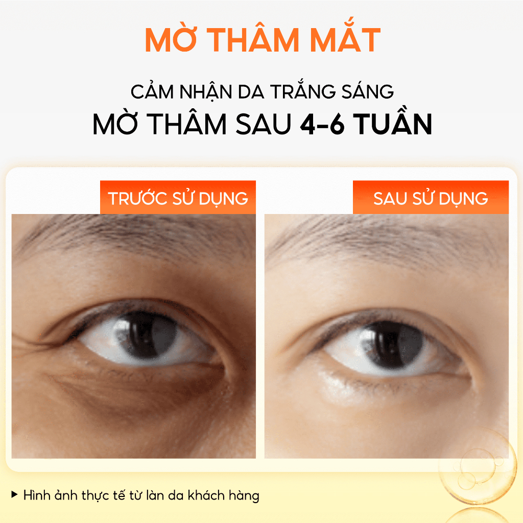 Giảm thâm mắt serum Nghệ Đỏ Nano Abera 15ml, serum mắt giảm quầng thâm mắt bọng mắt, chứa vitamin C dưỡng ẩm làm sáng da