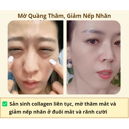 Gel Tan Bọng Mắt Dưỡng Ẩm Nâng Cơ Mắt Loại Bỏ Quầng Thâm Và Bọng Mắt Hiệu Qủa An Toàn