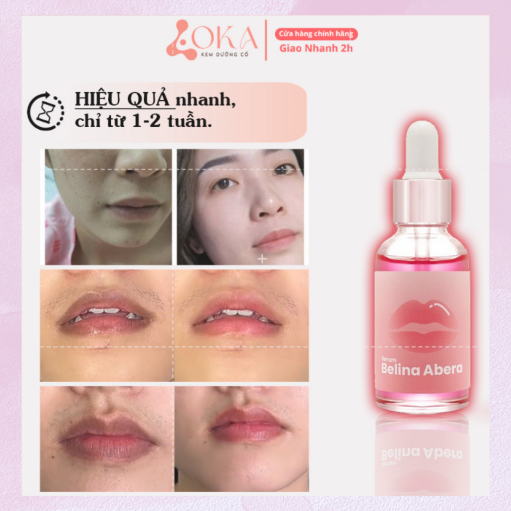 Serum khử thâm môi Belina dưỡng ẩm, hồng môi | Serum Belina Abera mờ thâm môi , mờ nám môi, giúp căng mịn – 20ml