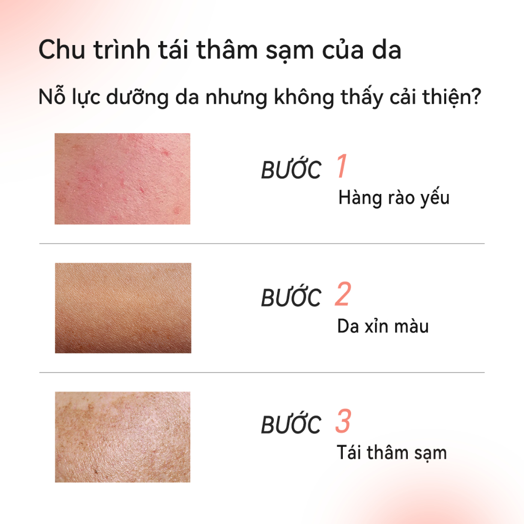 FOCALSKIN Serum Dưỡng Trắng Da Mờ Thâm Mụn Gấp Đôi Vitamin C + Niacinamide B3 + Alpha Arbutin 30ml