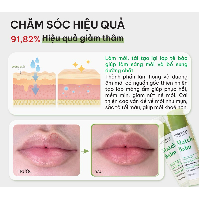 Son dưỡng môi thiên nhiên Matcha Balm, dưỡng hồng môi và phục hồi 5gr, Skinstory Việt Nam