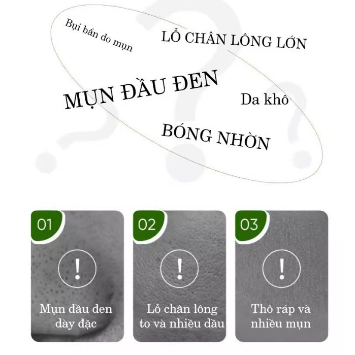 Mặt nạ than tre lột mụn đầu đen ZOZU giúp làm sạch sâu thu nhỏ lỗ chân lông hạn chế mụn cám kiểm soát dầu cho da