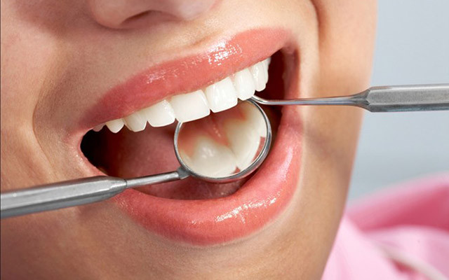 Nha Khoa Kĩ Thuật Cao Cẩm Tú - Quang Trung