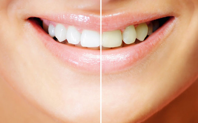 Nha Khoa 178 - Nhật Tảo