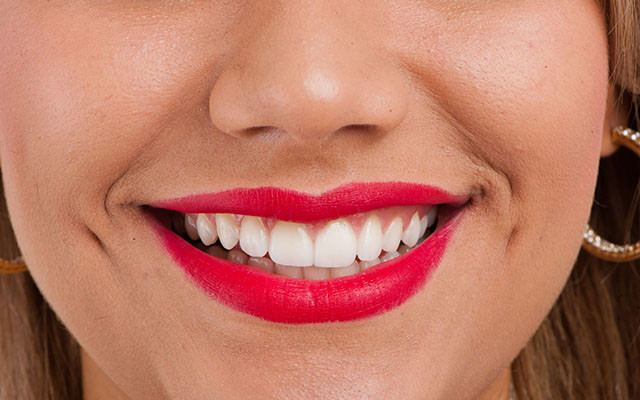 Nha Khoa Phương Việt - Nguyễn Thị Tần