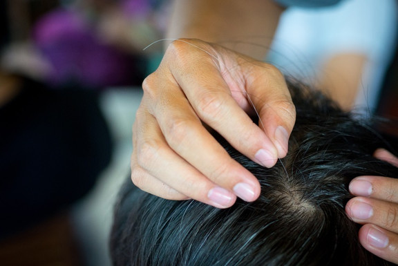 Nhổ Tóc Bạc Phương Anh