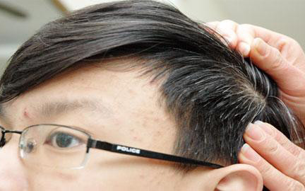 Nhổ Tóc Bạc - 668 Quan Hoa